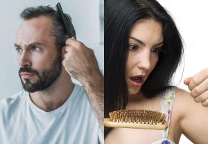 hair loss men and women 2