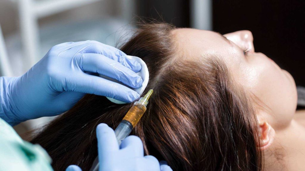 prp hair treatment - The hair loss clinic