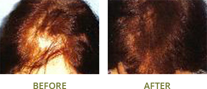 Befor and after image