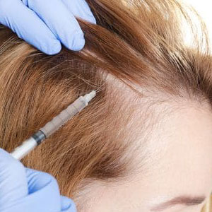 Microneedling