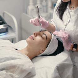 radiofrequency microneedling